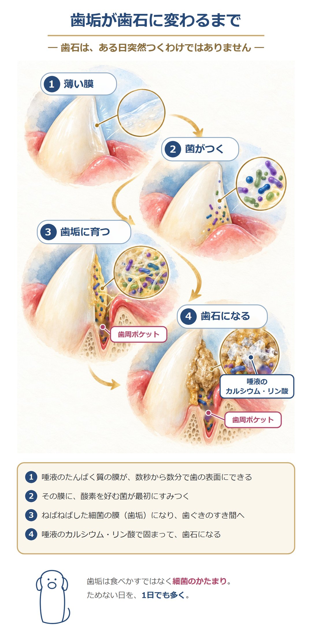 歯垢が歯石に変わるまで。唾液のたんぱく質の薄い膜に菌がすみつき、ねばねばした細菌の膜(歯垢)に育ち、唾液のカルシウム・リン酸で固まって歯石になる。歯垢は食べかすではなく細菌のかたまり